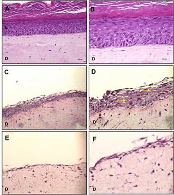 Mesenchymal stem cells express epidermal markers in an in vitro reconstructed human skin model